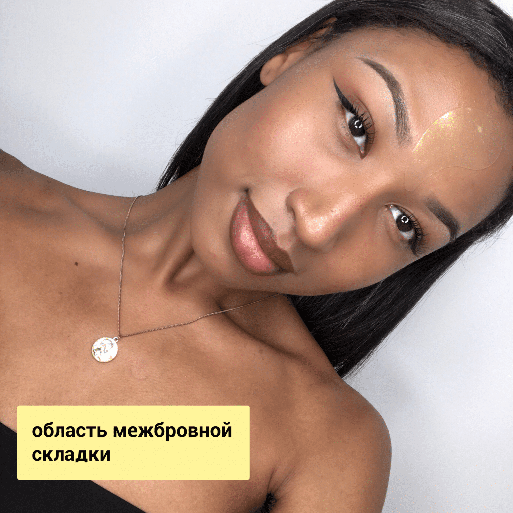 межбровная складка