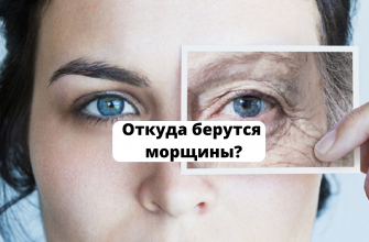 откуда берутся морщины