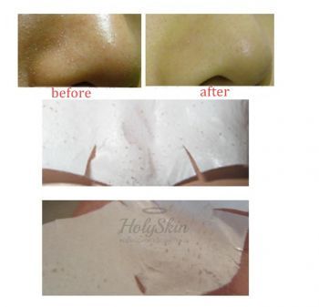 Speedy Solution Nose Pore Cleaning Patch 1p description