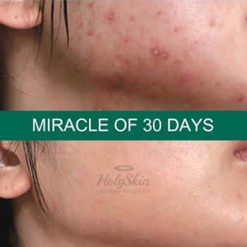 AHA BHA PHA 30 Days Miracle Cleansing Bar Мыло с кислотами для проблемной кожи