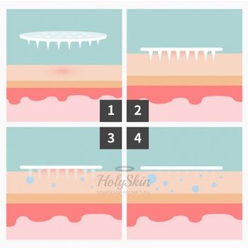 Madecassoside Needle Spot Patch Точечные патчи для проблемной кожи
