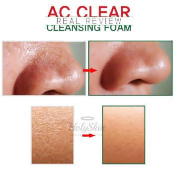 AC Clear Foam Eyenlip применение