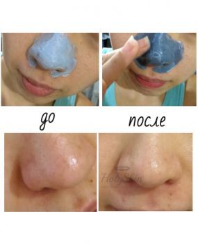 Volcanic Clay Black Head Heating Gel Mask description